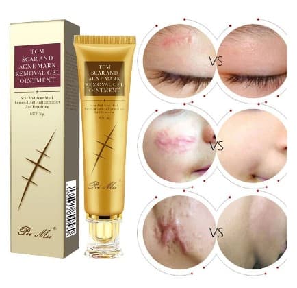TCM SCAR AND ACNE MARK REMOVAL GEL OINTMENT 30 G,